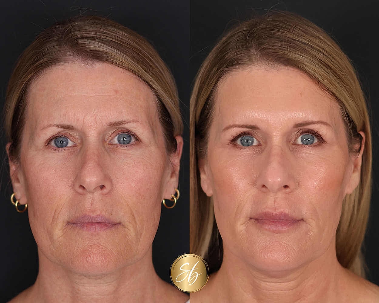 Before and after image showcasing facial transformation.