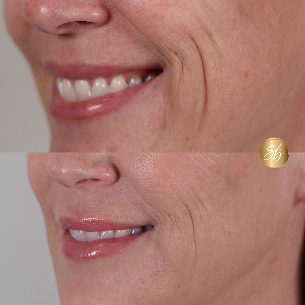 Side-by-side comparison of smile transformations.