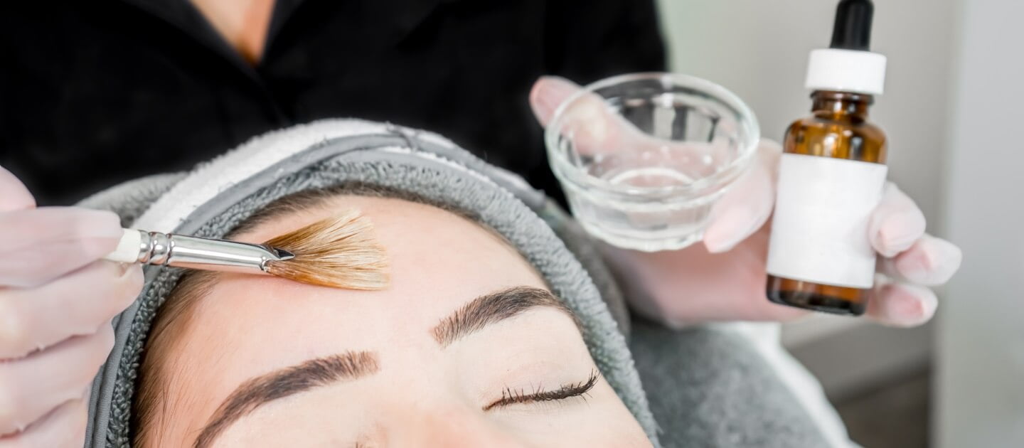 Chemical Peel Services in MiViejo, CA | Soul And Beauty Med X