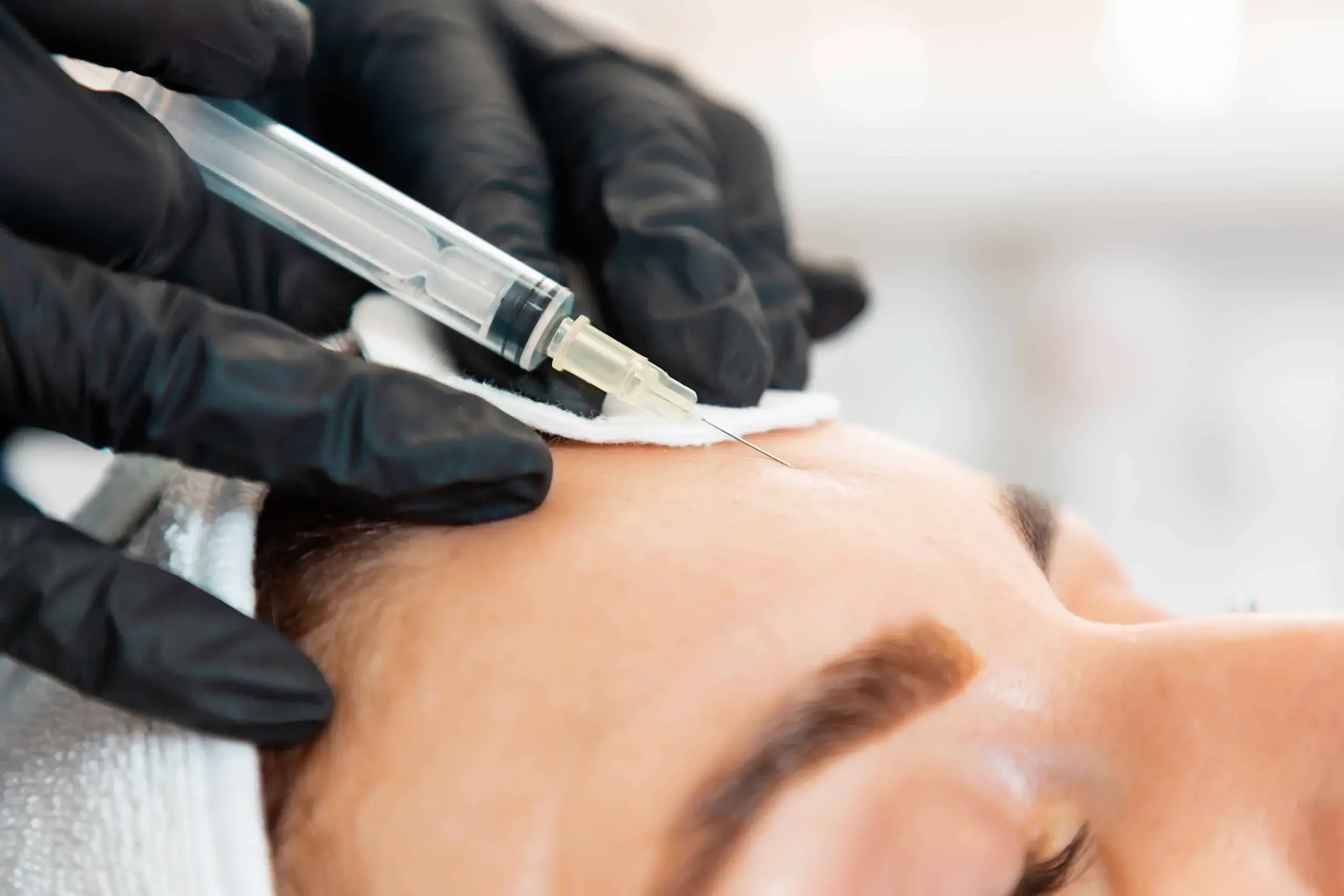 Botox getting injected on woman's forehead | Soul And Beauty Med X | Mission Viejo, CA