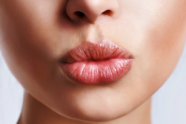 Lip Fillers | Soul and Beauty MEDx | Ladera Ranch