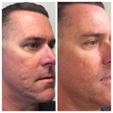 venus viva before after | Soul and Beauty MEDx | Mission Viejo, CA
